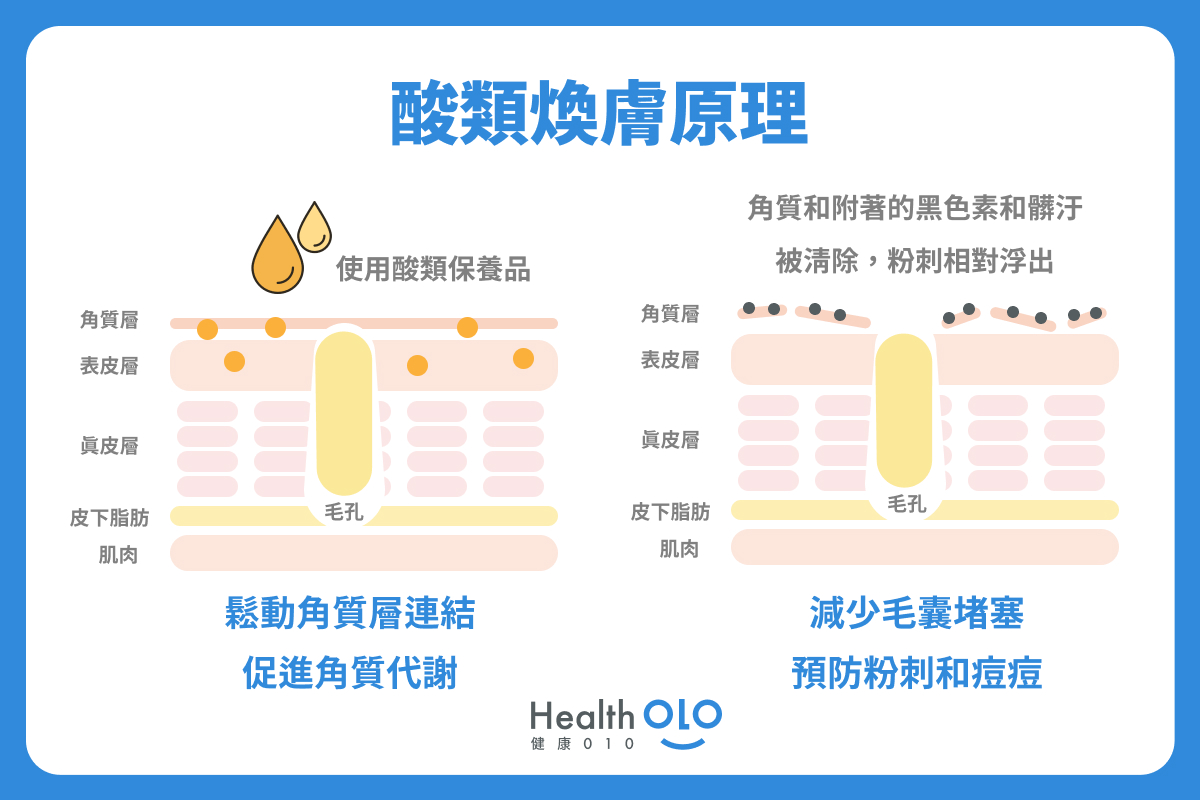 酸類煥膚原理