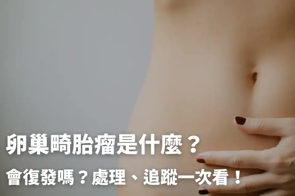 卵巢畸胎瘤是什麼？會復發嗎？處理、追蹤一次看！